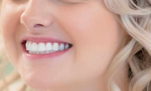 bright smile white teeth